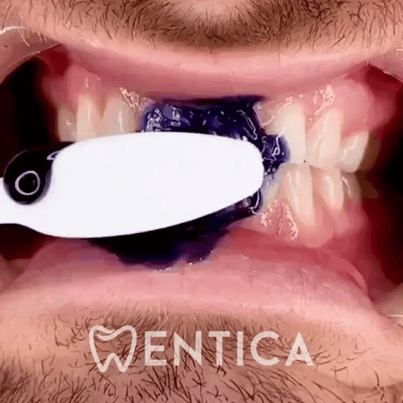 Sérum Correcteur de Couleur Violet︱SmileKit®