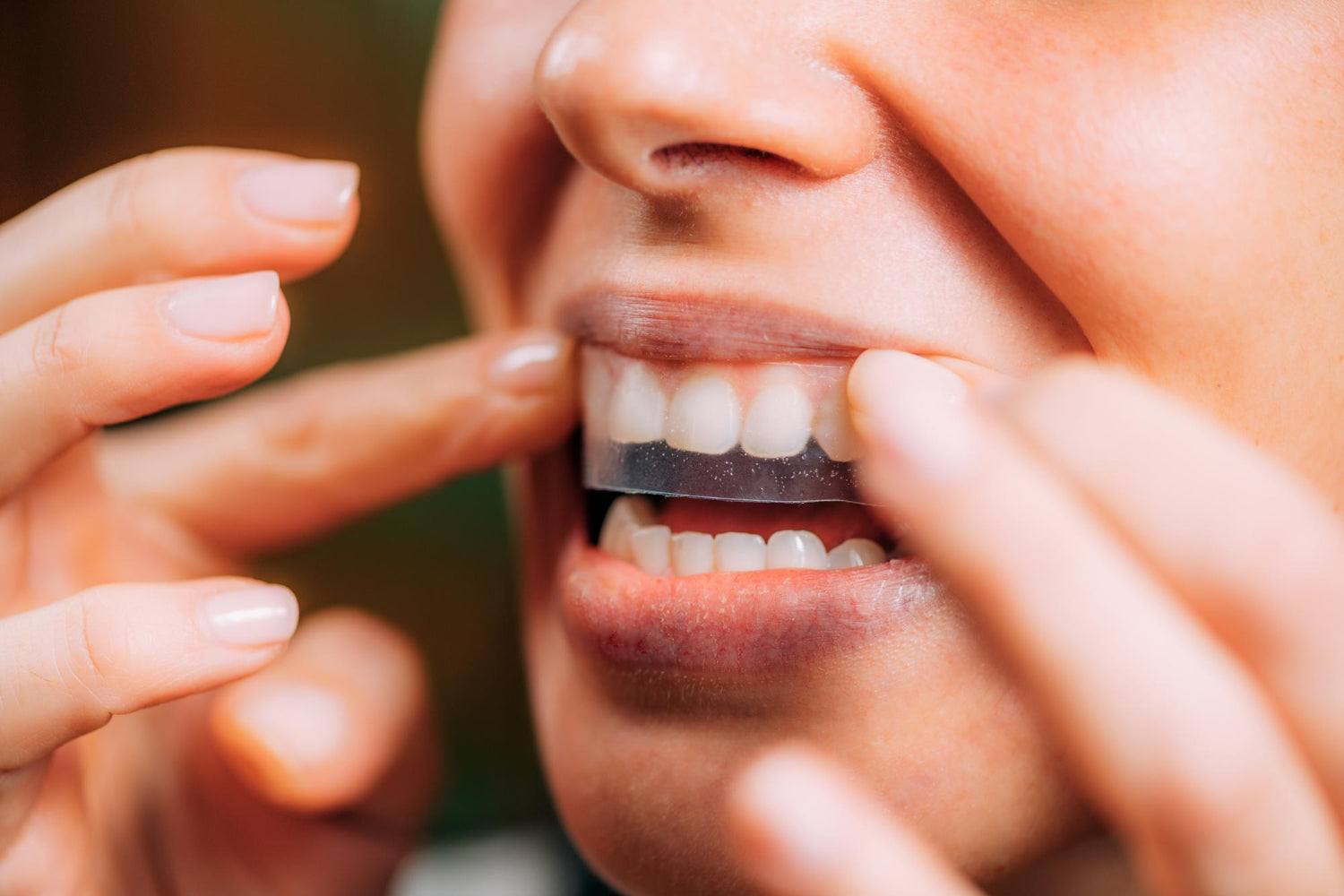 Comment se blanchir les dents en 1 jour ?