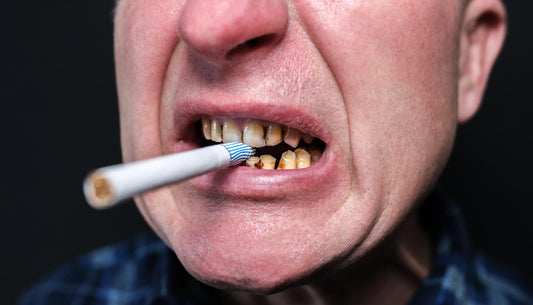 Dents d'un fumeur