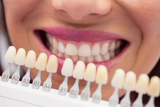 Nuance de couleur des dents