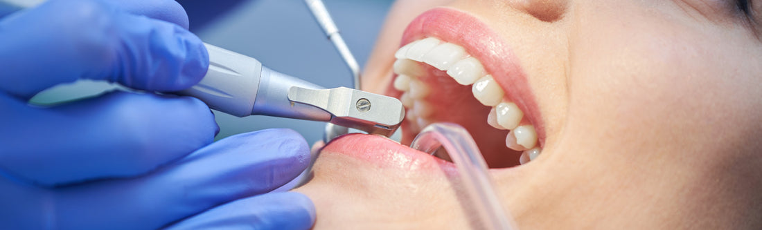 Détartrage Dentaire chez le dentiste 