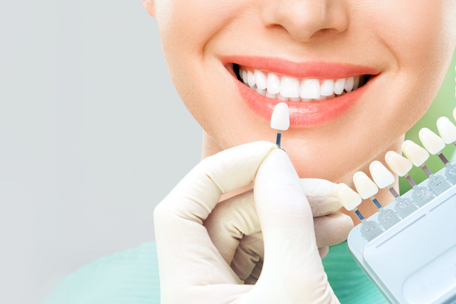 Blanchiment dent